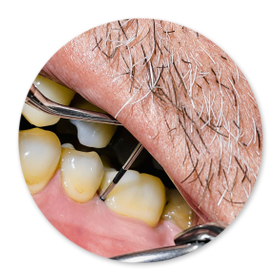 Dentalhygiene Patricia Ried | Kurs 3