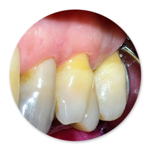 Dentalhygiene Patricia Ried | Kurs 6