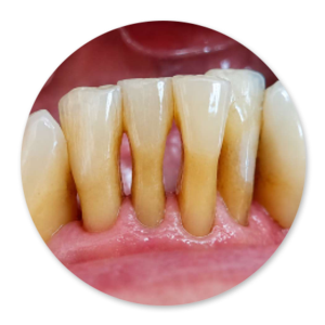 Dentalhygiene Patricia Ried | Kurs 6