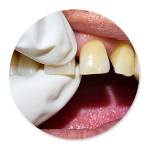 Dentalhygiene Patricia Ried | Kurs 6