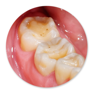 Dentalhygiene Patricia Ried | Kurs 7