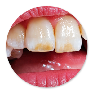 Dentalhygiene Patricia Ried | Kurs 1