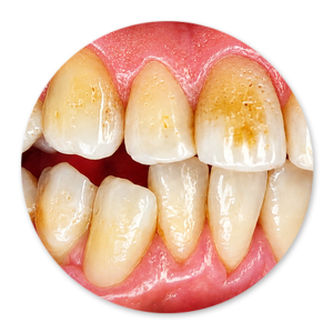Dentalhygiene Patricia Ried | Kurs 1