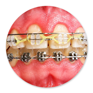 Dentalhygiene Patricia Ried | Kurs 1