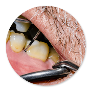 Dentalhygiene Patricia Ried | Kurs 4