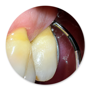 Dentalhygiene Patricia Ried | Kurs 9